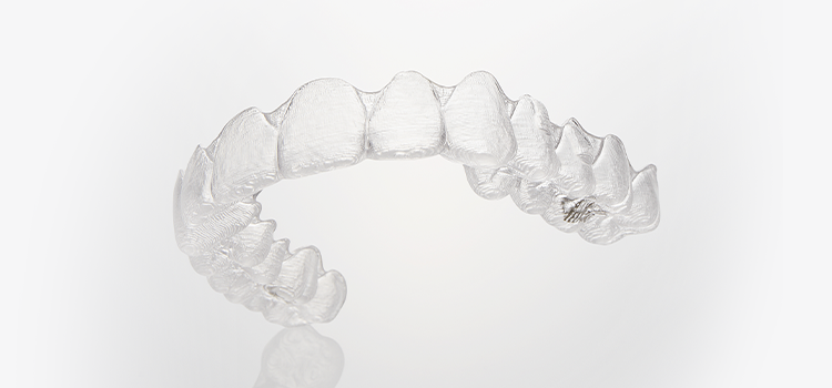 前歯の部分矯正２つの治療方法